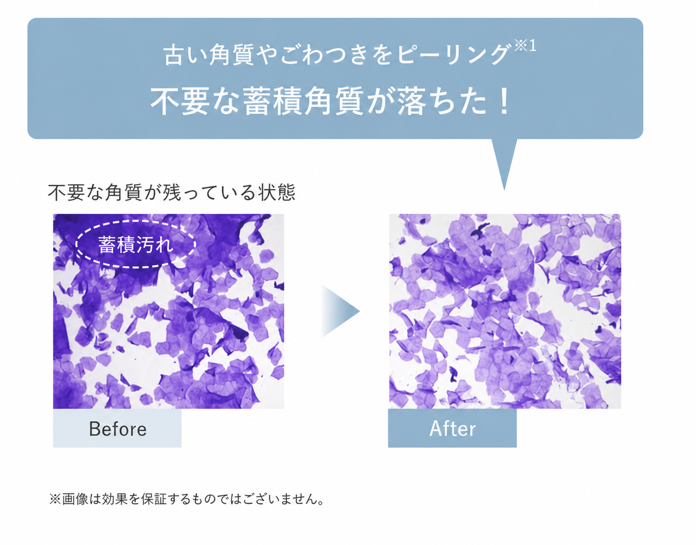 DUO CLEANSE SELUM,デュオ クレンズセラム ピール&ブースト,洗い流す美容液,ピーリング,スクラブ,クレンジング,@cosme ベストコスメアワード2026 上半期新作ベストクレンジング,プレミアアンチエイジング株式会社
